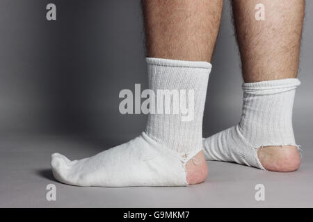 seitlich stehen Füße mit weißen Socken und ein großes Loch vor grauem Hintergrund Stockfoto