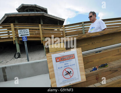 Stuart, Vereinigte Staaten von Amerika. 4. Juli 2016. 4. Juli 2016 An Algen ist Warnzeichen bei Badewanne Reef Beach in Stuart, Florida, am 4. Juli 2016 sehen. Die beliebten Badestrand, normalerweise beschäftigt auf der Fourth Of July-Urlaub, ist vor allem menschenleer, wie giftige Algenblüten im Wasser Grafschaft Beamten vorübergehend schließen den Strand zum Schwimmen gezwungen haben. (Paul Hennessy/Alamy) Stockfoto