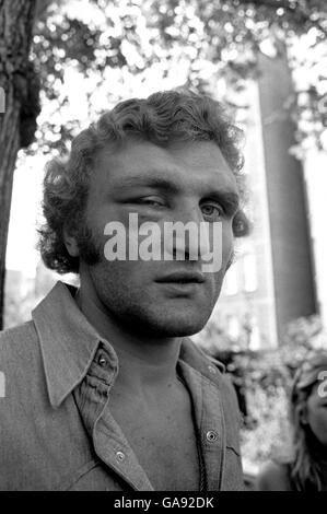 Ein ziemlich geschwollener Joe Bugner, am Morgen nach seiner Punkteniederlage gegen Joe Frazier Stockfoto