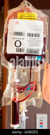 Bluttransfusion Stockfoto