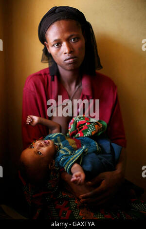 Aynate Desta mit ihrem Baby Abebe Dawit, 1, in der Aedo Clinic, Äthiopien. Zehntausende Äthiopier stehen kurz davor, infolge eines massiven Nahrungsmittelmangels zu verhungern. Etwa 3,200 Kinder und Frauen wurden in den letzten Wochen in nur einer südlichen Region zu Lebensmittelbehandlungsprogrammen zugelassen, da die Auswirkungen einer achtmonatigen Dürre die ländlichen Gemeinden in ihren Griff bekommen haben. Stockfoto