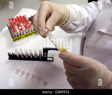 Ein Wissenschaftler behandelt Virusproben im West of Scotland Specialist Virology Centre am Gartnavel General Hospital, Glasgow, wo er Grippeproben auf Spuren der Schweinegrippe untersucht hat. Stockfoto