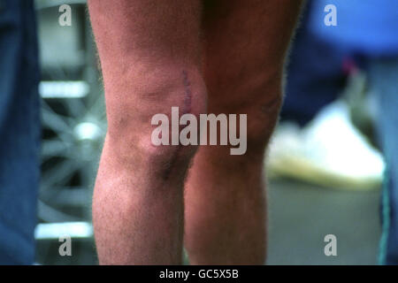 Fußball - beschädigt Paul Gascoigne die Knie - London Stockfoto