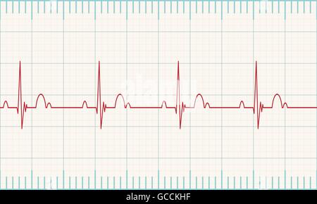 Medizinische Herzmonitor Messung der Herzfrequenz mit weißem Hintergrund. Vektor-Illustration Eps 10 Stock Vektor