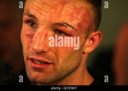 Der neue Super-Mittelgewicht-Weltmeister Mikkel Kessler während einer Pressekonferenz nach dem Kampf nach seinem 12-Punkte-Sieg über den britischen Carl Froch während des WBC Super Mittelgewicht-Titelkampfes in der MCH Arena in Herning, Dänemark. Stockfoto