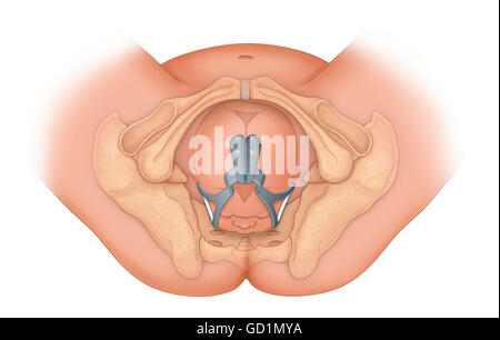 Ärztlicher Sicht eines Babys im Occiptital anterioren Position durch die bestimmungsgemäße Ingebrauchnahme der Zange geliefert Stockfoto