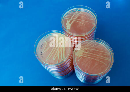 Petrischale mit Bakterien-Kolonien Stockfoto