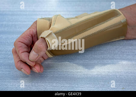 Arthritic Hand in ossur Neopren arthritis Handgelenk Daumen uk Strebe Stockfoto