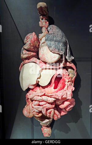Plastinat, Innere Organe Mit Raucherlunge, Dr. Gunter von Hagens, MeMu, Menschen-Museum, Berlin, Deutschland Stockfoto