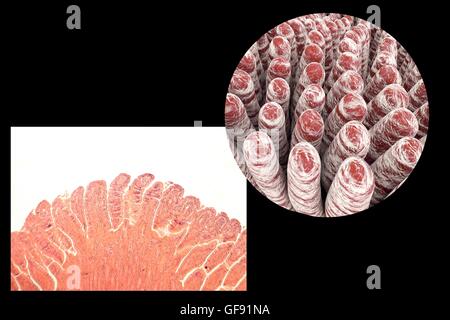 Darmzotten, leichte Schliffbild und 3D Computer Illustration. Darmzotten sind Finger-wie Projektionen, die die intestinale Fläche für die Aufnahme von Nährstoffen aus der Nahrung erheblich steigern. Das Epithel (äußere Schicht, gefaltet) von jedem Villus enthält En Stockfoto