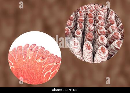 Darmzotten, leichte Schliffbild und 3D Computer Illustration. Darmzotten sind Finger-wie Projektionen, die die intestinale Fläche für die Aufnahme von Nährstoffen aus der Nahrung erheblich steigern. Das Epithel (äußere Schicht, gefaltet) von jedem Villus enthält En Stockfoto