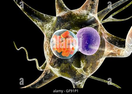 Tollwut-Virus-Partikel im Neuron, Computer Bild. Tollwut-Viren vermehren sich im Zytoplasma der Gehirnzellen (Neuronen). Ihre Anhäufung ist histologisch als sogenannte Negri Körper gesehen. Das Vorhandensein von Negri Körper innerhalb eines Gewebes Probe fr Stockfoto