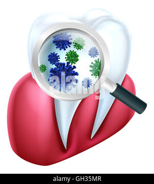 Eine zahnärztliche medizinische Illustration von einem Zahn und Zahnfleisch bedeckt in Bakterien, die durch eine Lupe betrachtet Stockfoto