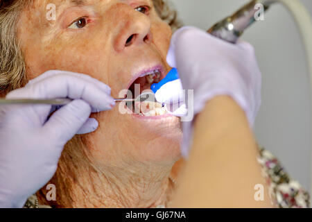 Ältere Frau, die ihre Zähne gereinigt durch eine Dentalhygienikerin Stockfoto