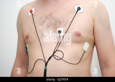 Ein Mann mit Holter-Monitor-Gerät Stockfoto