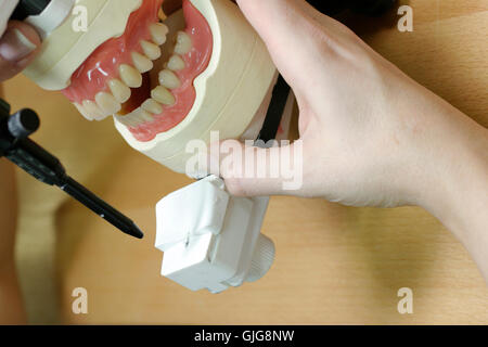 Dental-Modelle Ober- und Unterkiefer Stockfoto