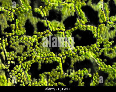 pflanzliche Zellen mit Chloroplasten, mikroskopische Stockfoto