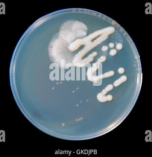 Petrischalen mit Kolonien von Mikroorganismen und Sporen der Pilze Stockfoto