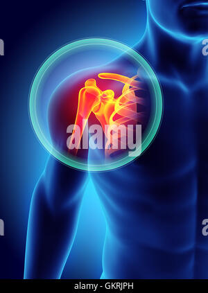 3D Illustration, Schulter schmerzhaft Skelett Röntgen, medizinisches Konzept. Stockfoto