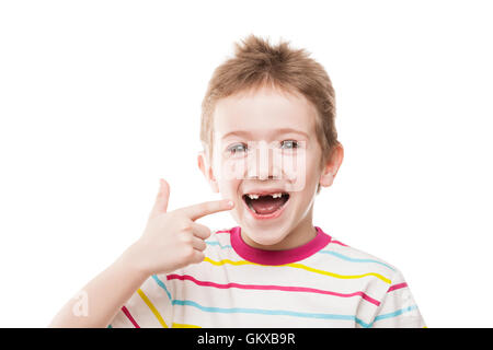 Erste Babymilch oder temporäre Zähne fallen aus Stockfoto