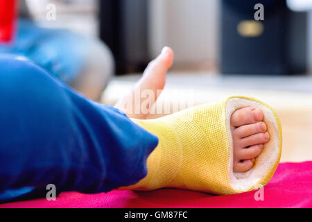 Gebrochenes Bein in Besetzung von unkenntlich kleiner Junge. Stockfoto