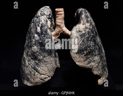 Aceton, menschlichen Lunge, Raucher, Körperwelten, Menschen-Museum, Berlin, Deutschland Stockfoto