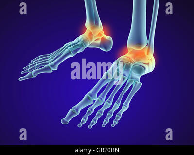 Skelett Fuß - Injuryd Talus Knochen. XRAY-Ansicht. Medizinisch genaue 3D-Illustration Stockfoto