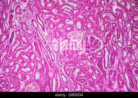 Menschliche Niere, kortikale Zone unter Mikroskop Stockfoto