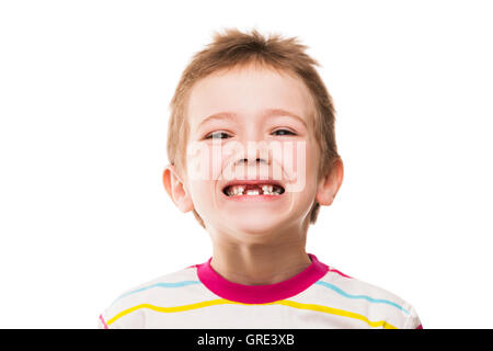 Erste Babymilch oder temporäre Zähne fallen aus Stockfoto