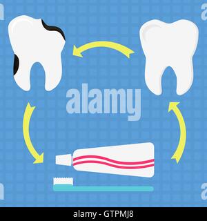 Kreisförmige Darstellung mit gesunder Zahn, verfallener Zahn, Zahnbürste und Zahnpasta. Als Symbol für die Vermeidung von Karies durch brus Stock Vektor