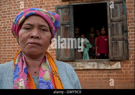 Albino-Mutter. Im Hintergrund, ihren vier Kindern und einem großen Kind (Madagaskar) Stockfoto