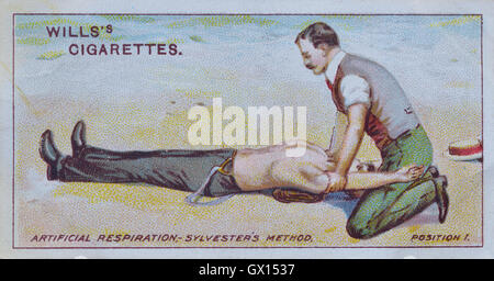 Wills Zigarette Karte künstliche Beatmung. Die Sylvester-Methode Stockfoto