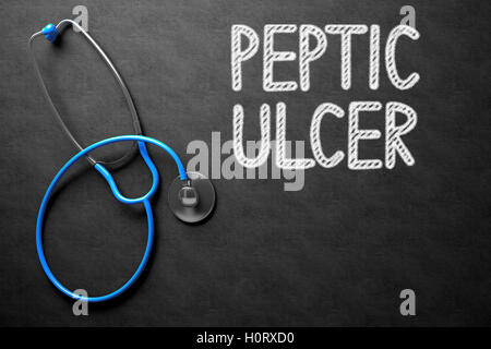Magengeschwür handschriftlich auf Tafel. 3D Illustration. Stockfoto