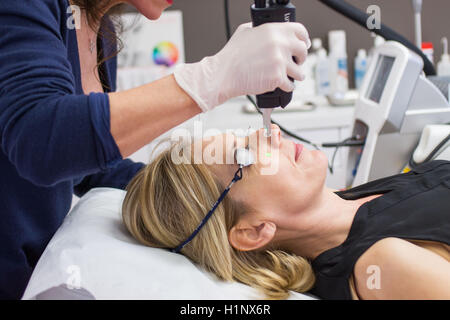 Vaskuläre Laser für die Behandlung von Rosacea und Varizen Stockfoto