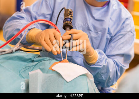 Nasennebenhöhlenchirurgie. Chirurgen, die funktionelle endoskopische Nasennebenhöhlenchirurgie durchführen. Stockfoto