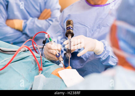 Nasennebenhöhlenchirurgie, Chirurgen durchführen funktionelle endoskopische Nasennebenhöhlenchirurgie, Krankenhaus in Limoges, Frankreich. Stockfoto