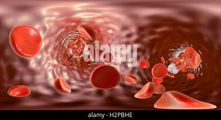 Erythrozyten und Leukozyten, Computer Bild. 360-Grad Panoramablick in Blut pro Schiff. Stockfoto