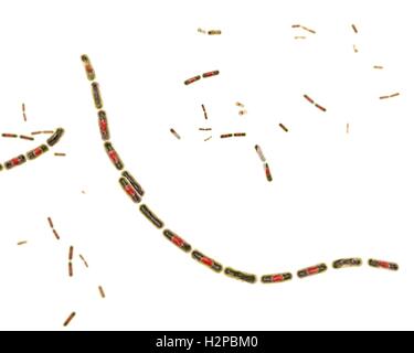 Milzbrandbakterien, Computer Bild. Anthrax-Bakterien (Bacillus Anthracis) sind die Ursache für die Krankheit Milzbrand bei Mensch und Vieh. Sie sind grampositive Spore-produzierenden Bakterien, die in Ketten (Streptobacilli) angeordnet. Viele Zellen haben eine zentrale Spore (rot). Stockfoto