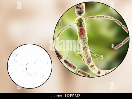 Milzbrandbakterien, leichte Schliffbild und Computer Illustration. Anthrax-Bakterien (Bacillus Anthracis) sind die Ursache für die Krankheit Milzbrand bei Mensch und Vieh. Sie sind grampositive Spore-produzierenden Bakterien, die in Ketten (Streptobacilli) angeordnet. Viele Zellen haben eine zentrale Spore (rot). Stockfoto