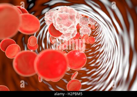 Im Inneren ein Blutgefäß während einer Entzündung. Computer-Darstellung, die erhöhte Zahl von weißen Blutkörperchen in das Blutgefäß eines Patienten mit Entzündung. Stockfoto