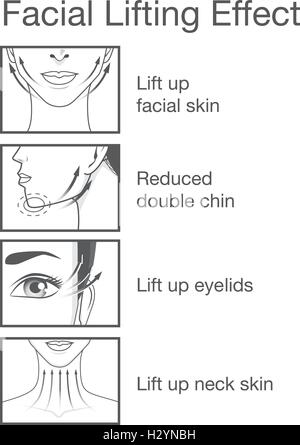 Lifting-Effekt auf Gesicht der Frauen Stock Vektor