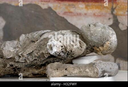 86 Abgüsse von archäologischen Ausgrabungen von Pompeji unterliegen einer Intervention der Erholung und der Wiederherstellung zu anthropologischen Stockfoto