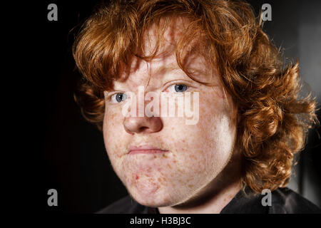 Emotionale Porträt der rothaarige, sommersprossige junge, Schauspieler-Portfolio, Kindheit-Konzept Stockfoto