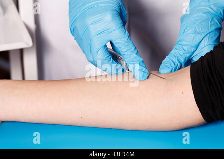 Medizin und Gesundheit, Blutproben für die Analyse Stockfoto