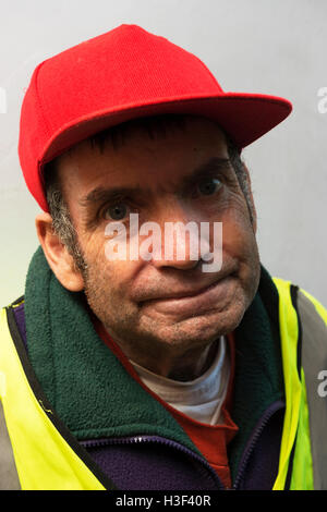 Applying Menschen mit Lernschwierigkeiten leiden unheilbar Kehlkopfkrebs Stockfoto