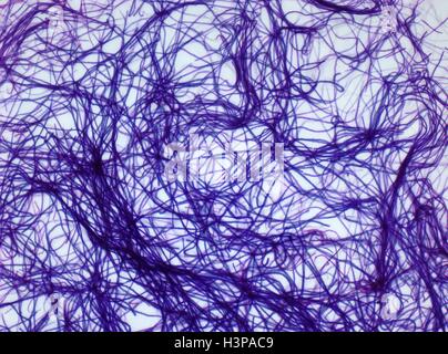 Anthrax-Bakterien. Leichte Schliffbild (LM) die stäbchenförmigen Bakterien, Bacillus Anthracis, Ursache von Milzbrand in Mensch und Tier. Es ist auf den Menschen durch Kontakt mit kontaminierten Tierhaare, Häute oder Kot übertragen. Die Krankheit tritt in zwei Formen, entweder Angriff auf die Lunge und verursachen Pneumonie, (Woolsorters Krankheit) oder der Haut, Herstellung von schweren Ulzeration (bösartige Pustel). Wenn behandelt, kann Antibiotika Milzbrand geheilt werden, unbehandelt kann es tödlich sein. Vergrößerung: X1000 auf 10 cm breit. Stockfoto