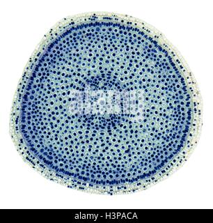 Mitose. Leichte Schliffbild (LM) der ein Querschnitt der Zwiebel (Allium Cepa) Wurzelspitze zeigen Zellen in Mitose (nuclear Division). Vergrößerung: X100 wenn bei 10 cm breite gedruckt. Stockfoto