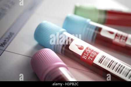 Blutproben Sie im Blut Reagenzglas. Stockfoto