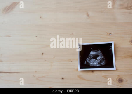 Sonogramm ein kleines Baby auf einem hölzernen Hintergrund. Stockfoto