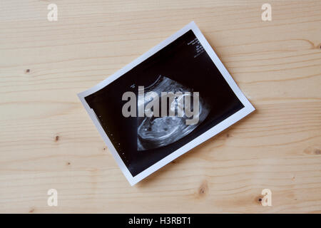 Sonogramm ein kleines Baby auf einem hölzernen Hintergrund. Stockfoto